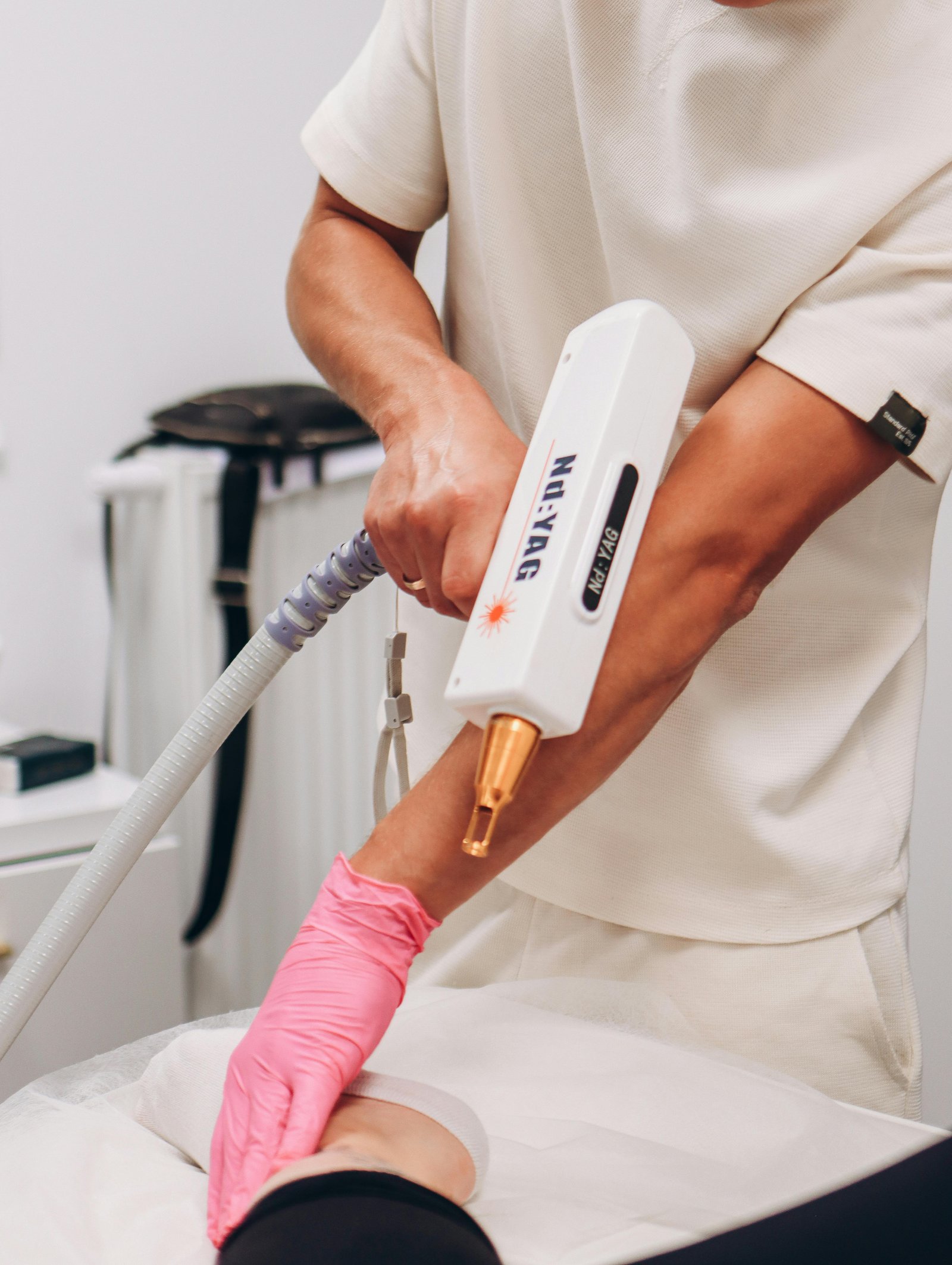 YAG Laser Treatment